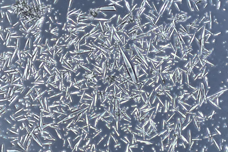 Charcot-Leyden crystals