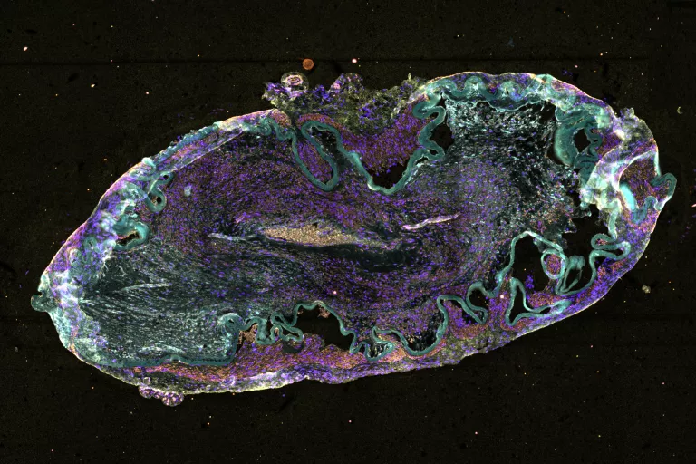 Spatial_Proteomics