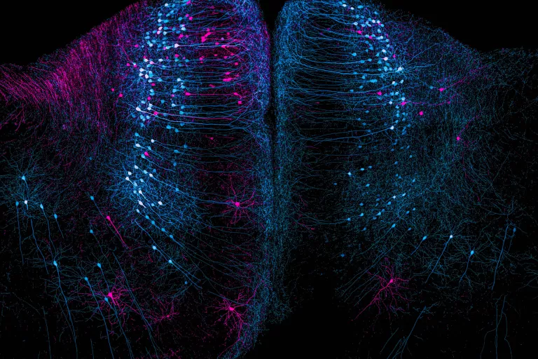 Retrograde labeled neurons in the cortex of a cortical mouse brain section, by Nikky Corthout and Alex Calzoni