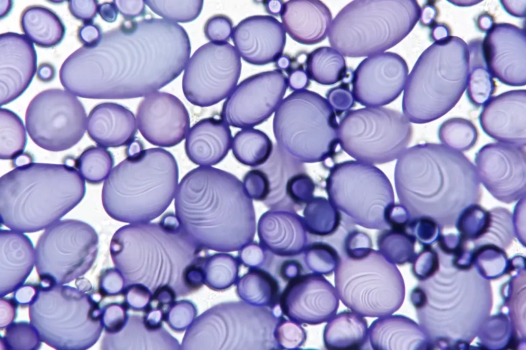Potato starch grains under microscope