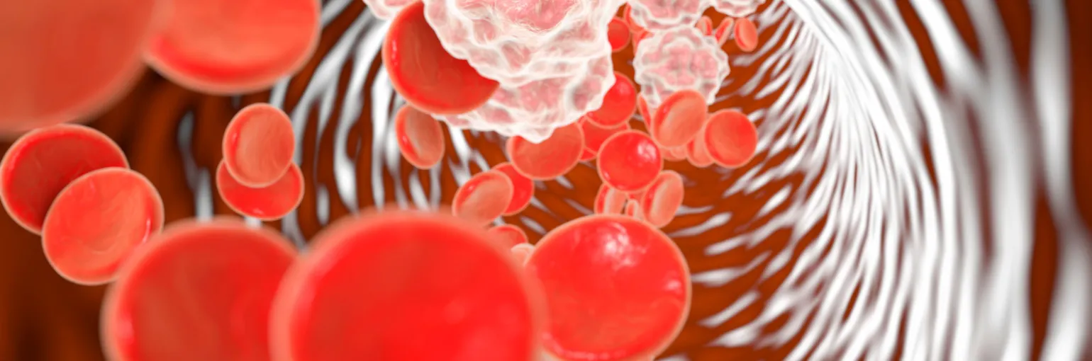 Center for Inflammation Research