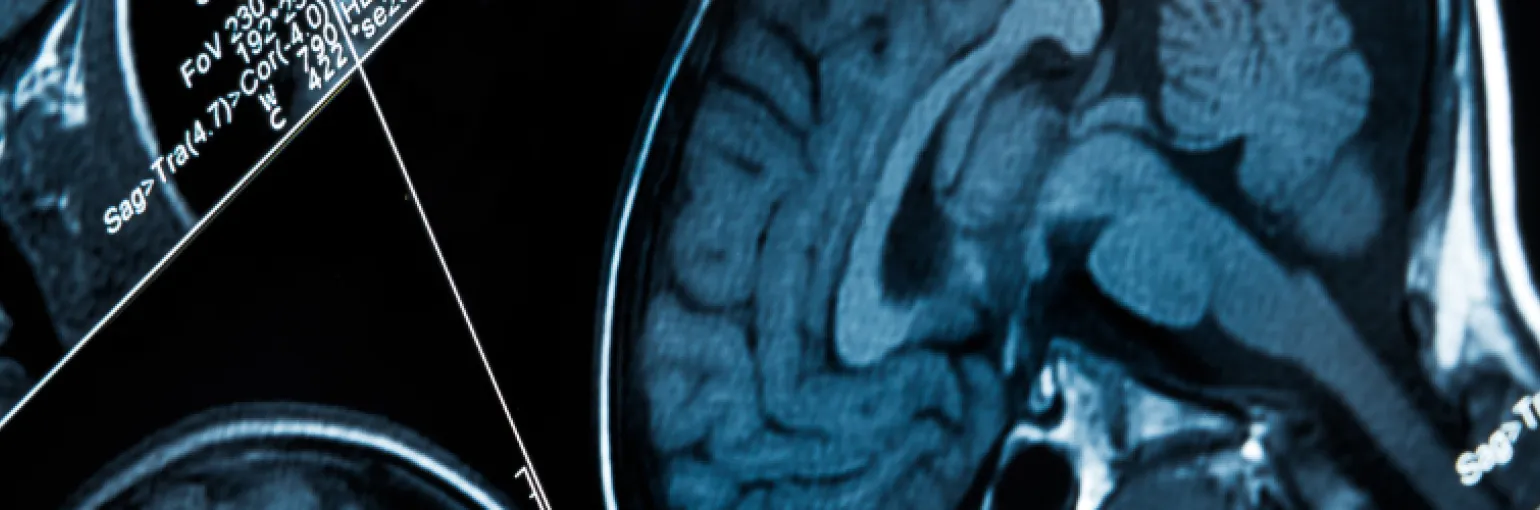 Targeting drugs on the brain result