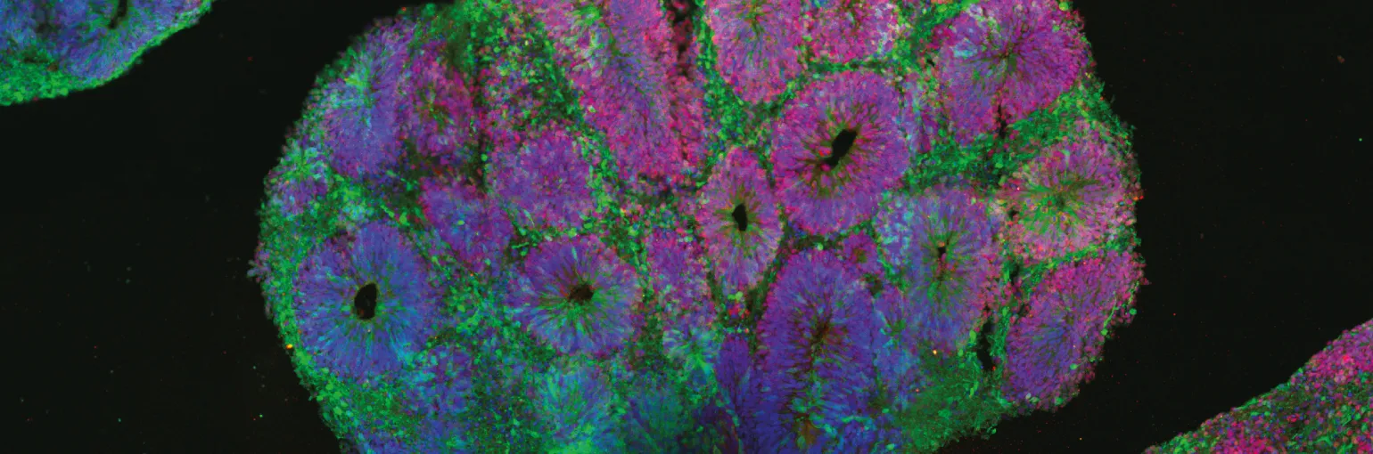 Cover annual report