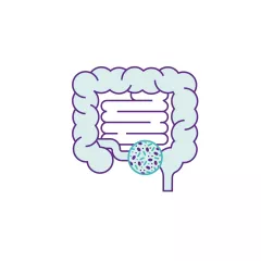Inflammatory bowel disease